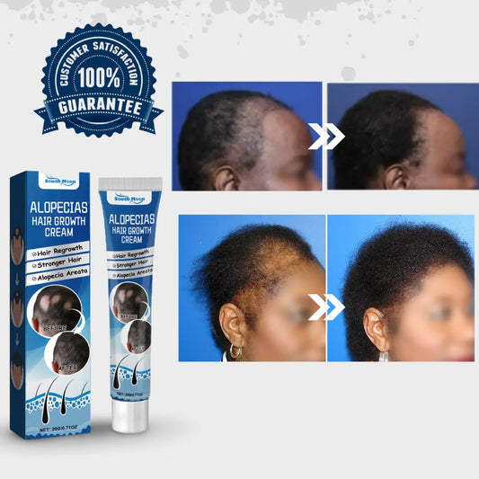 Alopecia Hair Growth Cream is a 100% natural, proven solution trusted by thousands!