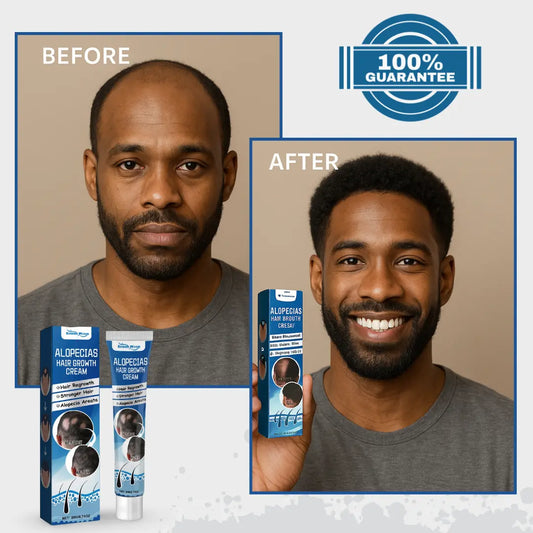 Alopecia Hair Growth Cream is a 100% natural, proven solution trusted by thousands!