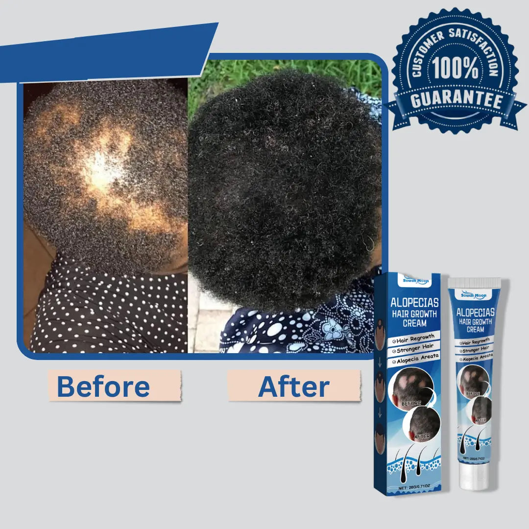 Alopecia Hair Growth Cream is a 100% natural, proven solution trusted by thousands!