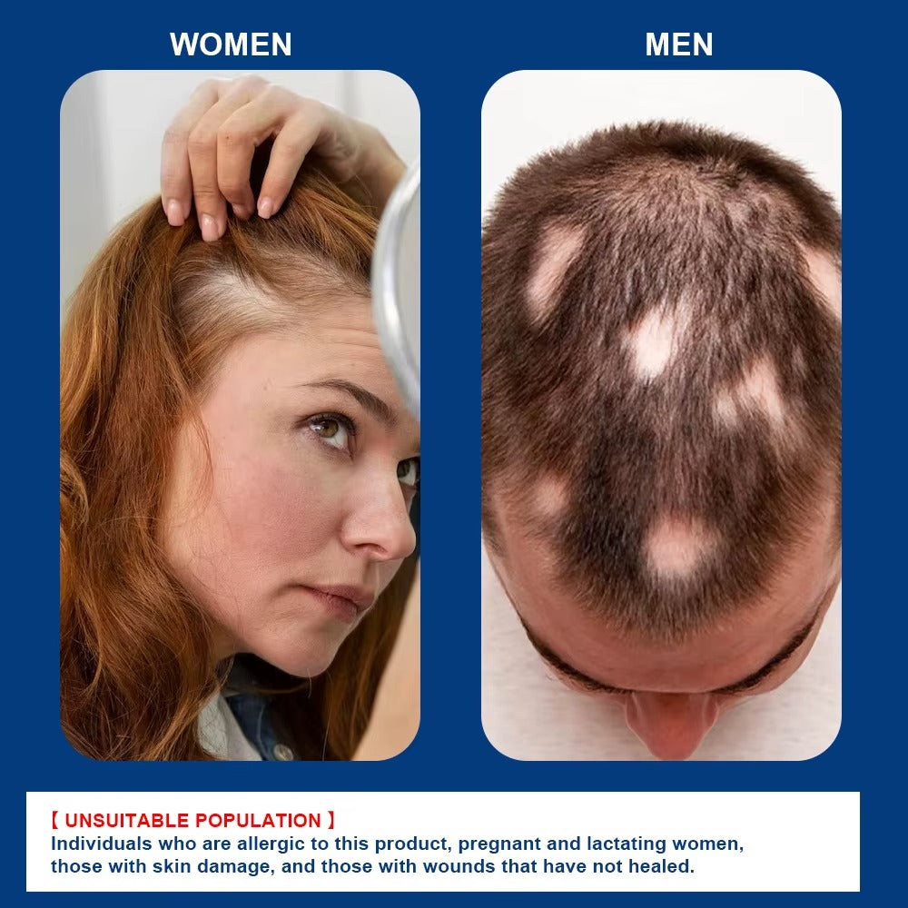Alopecia Hair Growth Cream is a 100% natural, proven solution trusted by thousands!