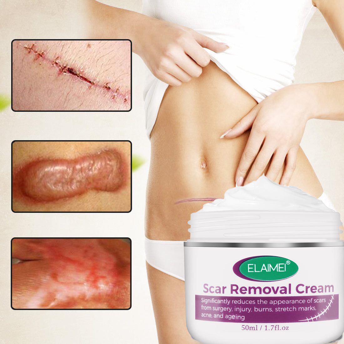 Scar Removing Cream – Effective Repair for Clearer Skin Zero side effect