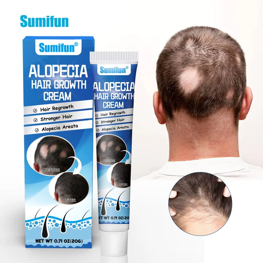 Alopecia Hair Growth Cream is a 100% natural, proven solution trusted by thousands!