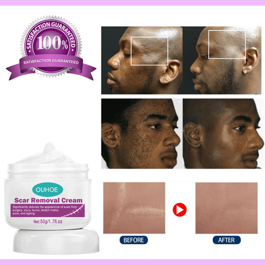 Scar Removing Cream – Effective Repair for Clearer Skin Zero side effect
