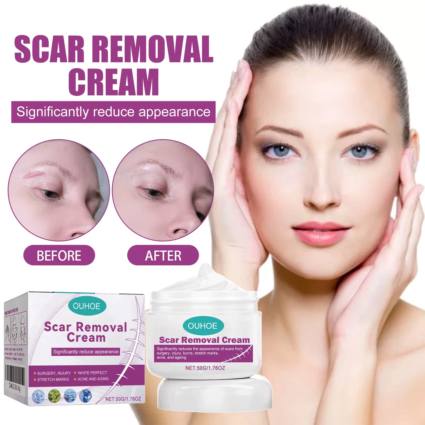 Scar Removing Cream – Effective Repair for Clearer Skin Zero side effect